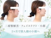 めい鍼灸院