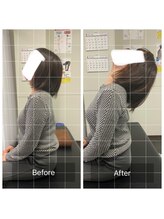 ナオル整体 浅草院(NAORU整体)/40代女性肩こり【後屈】