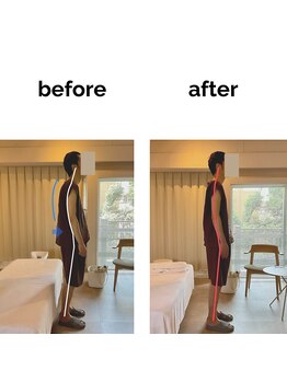 フィデル(fidele)/眼精疲労を伴う姿勢不良例