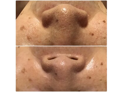 トータルビューティサロン リボーテ(Re:Beaute)の写真