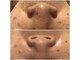 トータルビューティサロン リボーテ(Re:Beaute)の写真