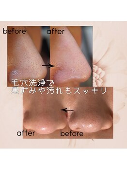 L’la citta【パーソナルカラー/毛穴洗浄/まつげパーマ/ヘッドスパ】/毛穴の汚れをスッキリ取り除く