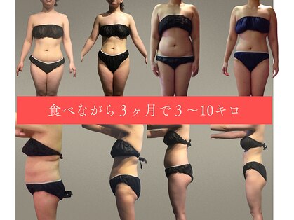 サンテボーテ(Sante Beaute)の写真