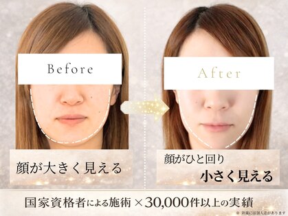 アロハ(ALOHA.)の写真