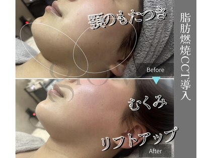 グロウ(glow.)の写真