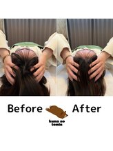 クマの冬眠 高知店/エラ張り、食い縛り