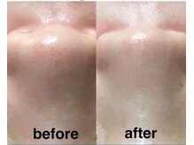 ケイココ(Keicoco)/