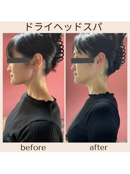 アルパカ(ALPAKA)/姿勢が気になる方！