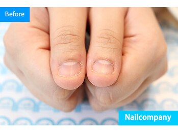 ネイルカンパニー/