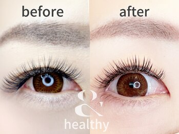 ヴィーヴ アイラッシュ(vive eyelash)/【アンドヘルシー】ビフォアフ