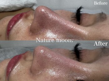 ナチュールムーン(Nature moon.)/毛穴洗浄