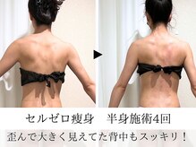 ウイ ネイルアンドビューティー(u'i nail&beauty)/凝りを解して正しい姿勢に♪