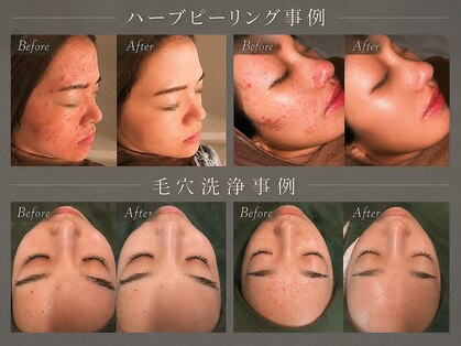 ベル 栄(Belle)の写真