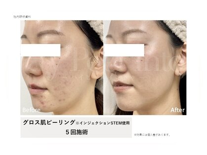 ティンク 心斎橋(Tink)の写真