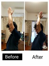 アース エンジェル整体院/ビフォアフ　肩こり　ストレッチ