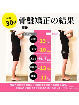 セレンディピティ 刈谷店(Serendipity)/【美容骨盤矯正】痩身ダイエット