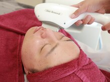 シープ(Sheep)/【ヒゲ光脱毛】新規様¥3980