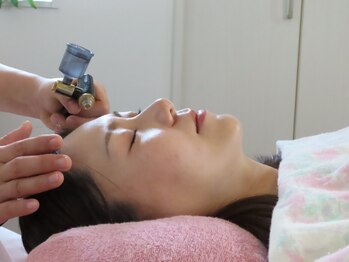 マホロ(MAHORO)の写真/お客様のお肌のお悩みを改善！美容鍼でお顔の血流＆トーンUP！くすみ解消、ツヤハリが出て理想の素肌に◎