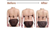 ヴィセル(VISEL)/トータルマイナス10cm痩身