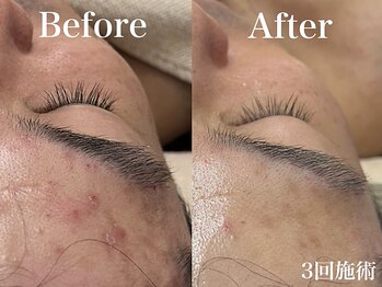 モリタ鍼灸整骨院/男性のお客様もご利用頂けます