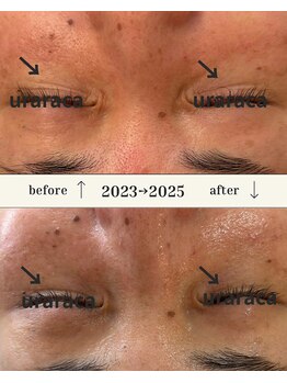 ウララカ(uraraca)/継続が本当に大事!!