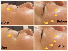 サロン ド ジョワ(salon de joie)/目尻シワ消えた？！