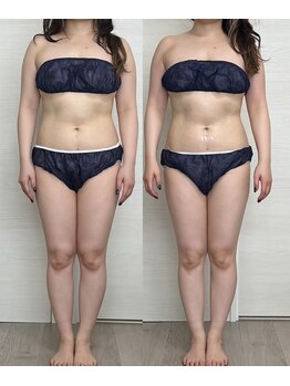 ヨルエステ(yoru aesthe)/【姿勢、リンパドレナージュ】