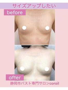 コライユ(corail)/ビフォーアフター