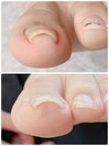歩くと痛いなとお悩みの方