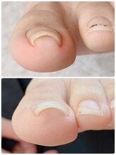 エトレ 大垣(Et-Re:)/歩くと痛いなとお悩みの方