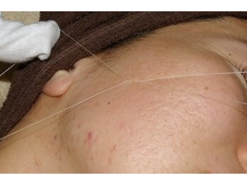 トータルビューティーサロン アリス(ALICE)/シルク糸エステ