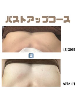 アイリス(AIRIS)/バストアップ/バストケア/ハリ