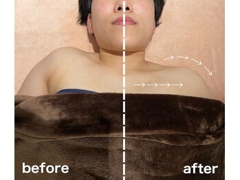 クリア(CLEAR)/リヴァイセルボディ