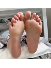 リンネ(Rinne)/角質ケア