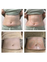 カルム(calme)/腸の動きを甦らせる！