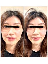 リカバリー和(リカバリーNagomi)/小顔美人へ！