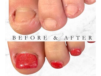 グラシナ 鳥丸店/2枚爪の原因