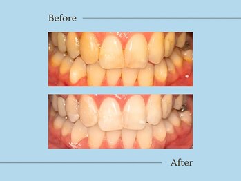 ルアナ(Luana)/初回Naturalメニュー施術例