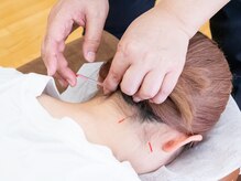 当院オリジナル鍼灸整体マッサージ☆肩こり・頭痛・腰痛・めまい