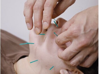 やの鍼灸治療院の写真/見た目年齢を引き上げる『乾燥肌』。美容鍼で内側から変わる!!究極のエイジングケアでハリ艶に満ちた素肌へ