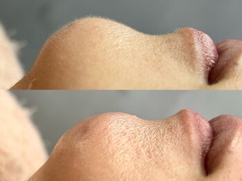 アイラッシュアンドネイル マカレア(Maka Le'a)/