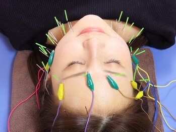 恵比寿駅前整骨院はり院 別館/美容鍼　小顔　リフトアップ　