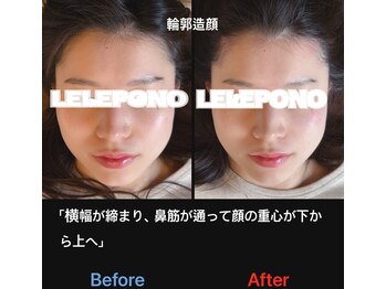 美容矯正サロン レレポノ(LELEPONO)/