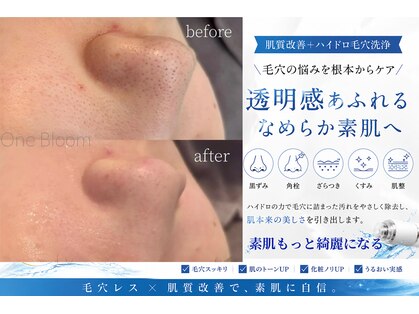ワンブルーム(OneBloom)の写真