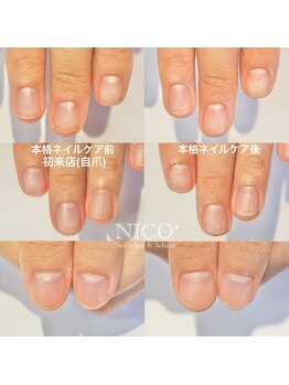 ニコプラス(NICO+)/爪育ネイルケア