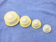 みなみ接骨院/ファンクショナルカッピング