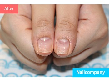 ネイルカンパニー/