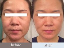 ビューティースタジオ韓美 渋谷店/お客様のbefore/after