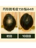 【円形脱毛でお悩みの方】カウンセリング￥8000→￥2980　
