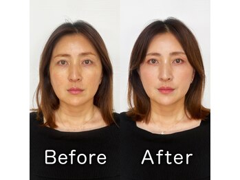 プリップ 中目黒(Pulip)/【40代お客様】ビフォーアフター